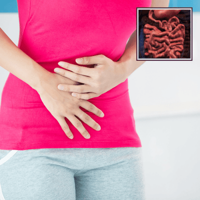 Occasional Diarrhea Plan | Instructions and Whole Food Supplements | Standard Process